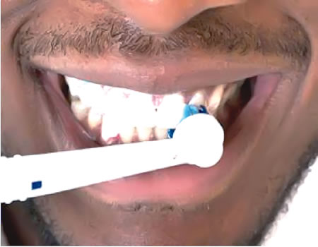 whitening tooth